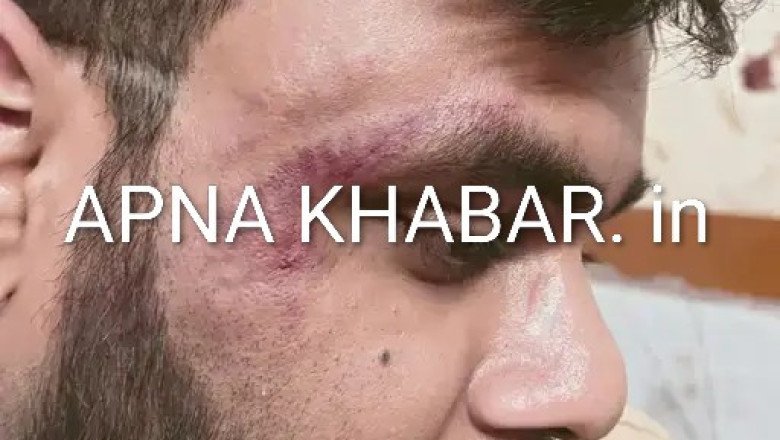 लो अब कोरबा में डॉ. विश्वास पर हुआ जानलेवा हमला...आखिर बात क्या थी