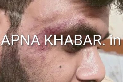 लो अब कोरबा में डॉ. विश्वास पर हुआ जानलेवा हमला...आखिर बात क्या थी