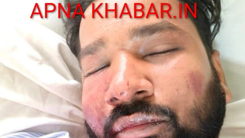 कोरबा  बिग ब्रेक :देर रात हुआ कांड ASI के बेटे को कुचला,पत्रकार पर पिस्टल ताना,फायरिंग की,अधमरा होते तक मारा,मरा समझकर लूटे और छोड़ भागे